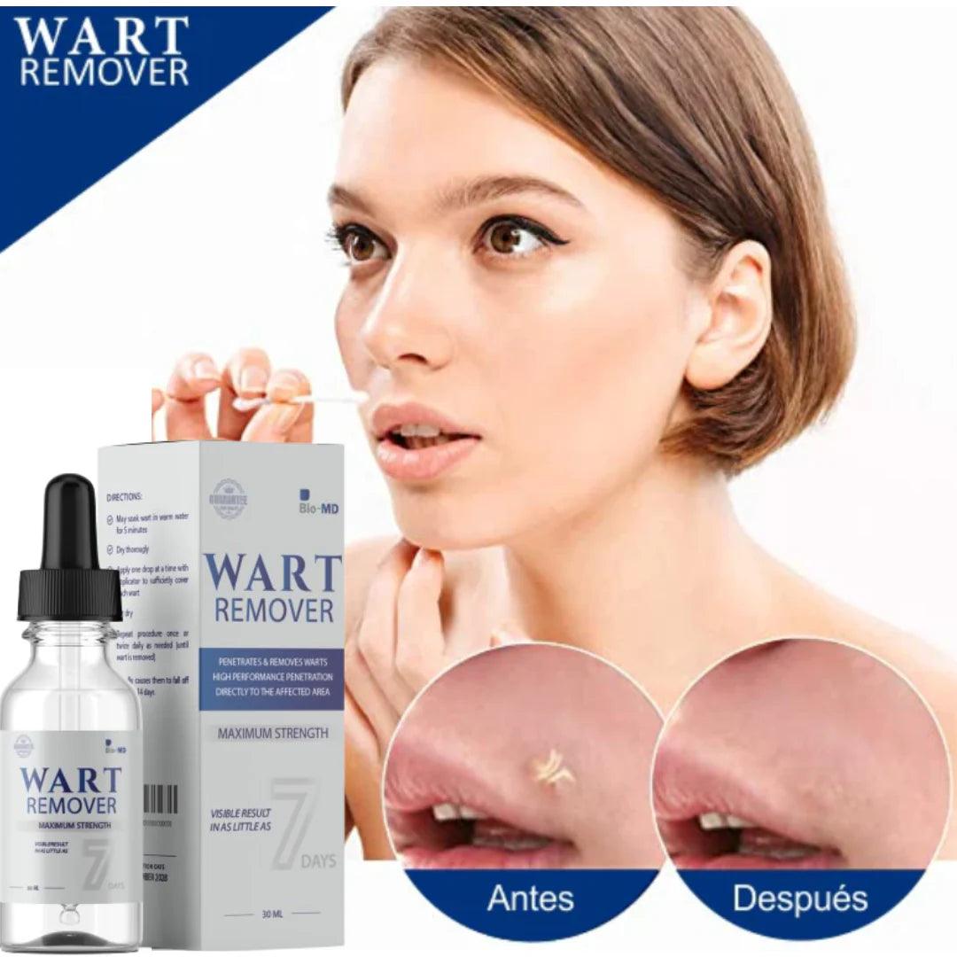 WART REMOVER AZUL