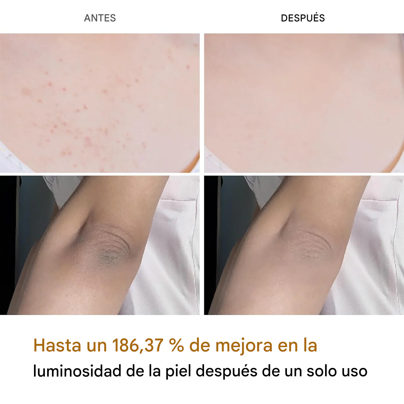 ¡Aclara las Zonas Oscuras y Recupera una Piel Uniforme con Melaxin! ⭐⭐⭐⭐⭐